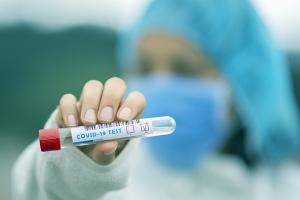 В Нижегородской области выявлено 215 новых заболевших коронавирусом, 125 пациентов выздоровели, 3 умерли