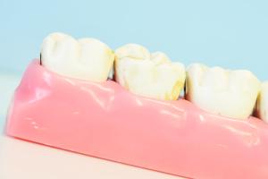 Зубы мудрости: больше, чем просто зубы