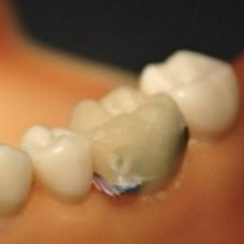 Датчик изо рта проследит за здоровьем