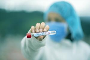 В Нижегородской области выявлено 307 новых заболевших коронавирусом, 135 пациентов выздоровело, 3 умерло