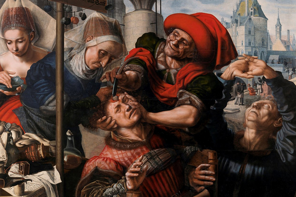 Инки проводили операции по трепанации черепа