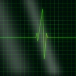 Смартфон сделает кардиограмму