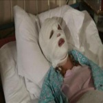 Дзержинские медики сожгли ребёнку лицо 