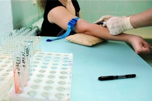 В Нижнем Новгороде зарегистрировано более 14 тыс. случаев ВИЧ инфекции