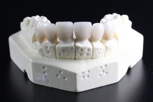Из чего делали зубные протезы в 19 веке 
