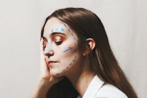 Целесообразность подтяжки лица